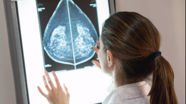 Revolución en oncología: Fármaco prolonga la vida de mujeres con cáncer de mama metastático