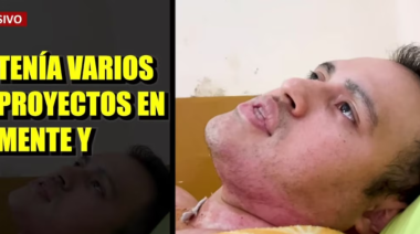 Amistad mortal: Joven quemado por su "hermano" revela aterrador ataque