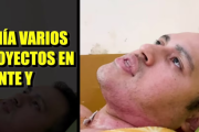 Amistad mortal: Joven quemado por su "hermano" revela aterrador ataque