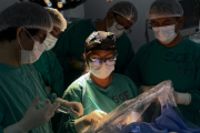 Paciente despierta durante cirugía cerebral: exitosa operación en hospital público peruano