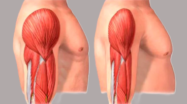 Sarcopenia: el enemigo silencioso que afecta al 20 % de adultos mayores en Lima