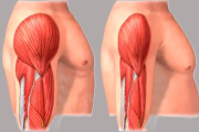 Sarcopenia: el enemigo silencioso que afecta al 20 % de adultos mayores en Lima