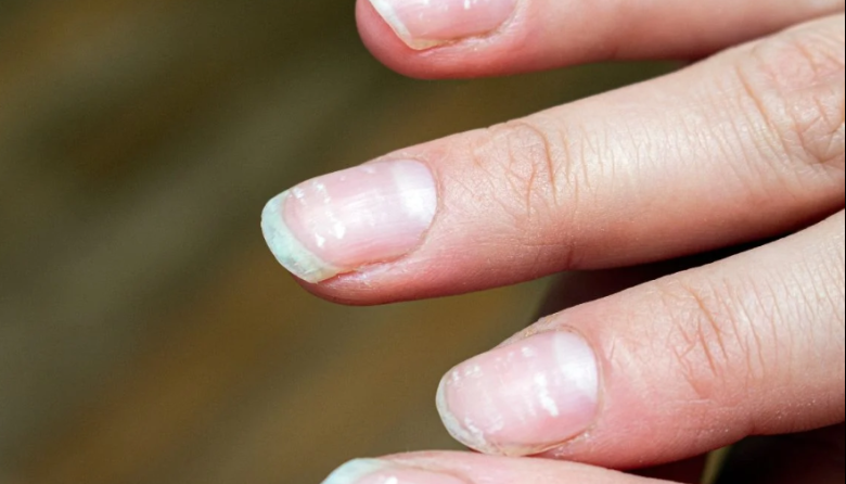 Esmalte del futuro: científicos crean uñas que liberan medicamentos
