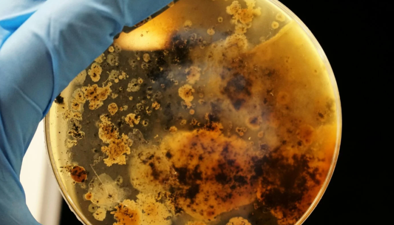 Nueva cepa de bacteria resistente a antibióticos se extiende en Europa y afecta principalmente a niños