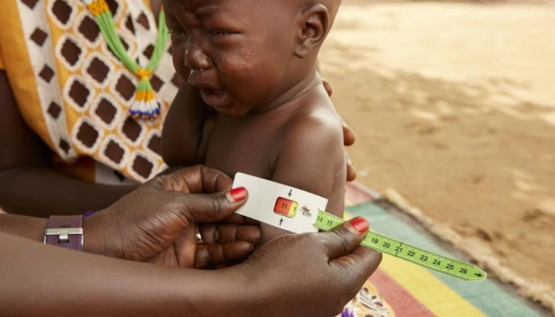 UNICEF alerta que hasta 825 000 niños sudaneses podrían sufrir desnutrición grave en 2026