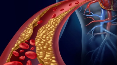 Alimentos clave para reducir el colesterol y cuidar la salud cardiovascular