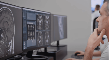 Inteligencia Artificial Revoluciona la Medicina: Quibim Predice Enfermedades desde Imágenes Médicas