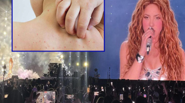 Alerta sanitaria en Nueva Jersey: temen contagio masivo de sarampión en concierto de Shakira