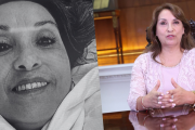 Investigación revela que Dina Boluarte se sometió a cuatro cirugías estéticas en 2023: Detalles de la operación