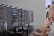 Inteligencia Artificial Revoluciona la Medicina: Quibim Predice Enfermedades desde Imágenes Médicas