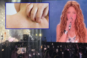 Alerta sanitaria en Nueva Jersey: temen contagio masivo de sarampión en concierto de Shakira