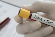 PNP podrá tomar muestras de ADN para identificar criminales y desaparecidos